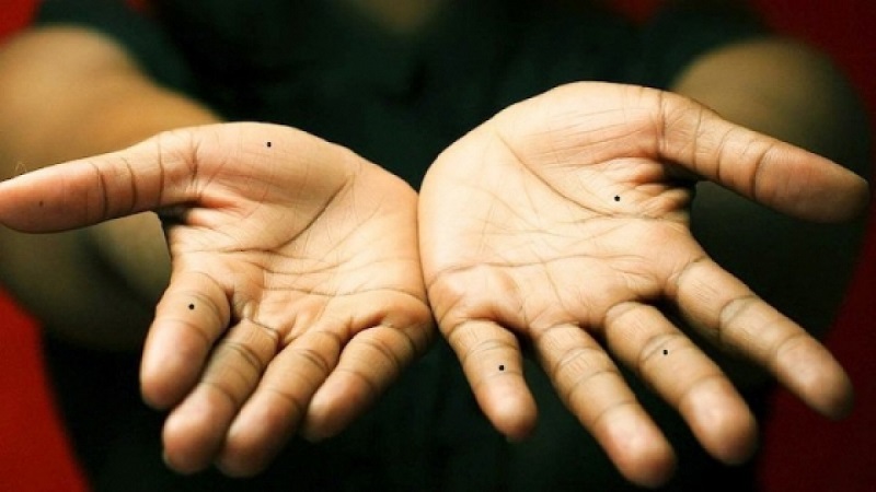 ý nghĩa chung của nốt ruồi ở lòng bàn tay 