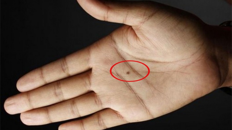 ý nghĩa nốt ruồi ở lòng bàn tay chính giữa
