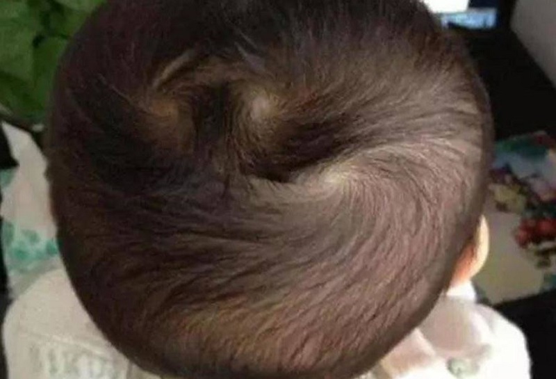 Cha mẹ xem xoáy tóc đỉnh đầu đoán định tương lai con trẻ 3 xoáy